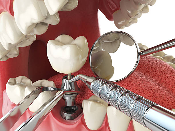 Best Pediatric Emergency Dentist in Weaver, AL